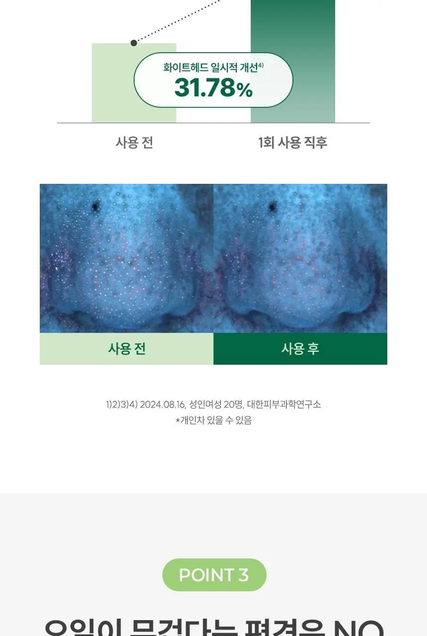 [피지제거] 아크네스 포하 딥 클렌징 오일 200mL 기획 (+ 여행용 30mL 증정) 상세페이지 13